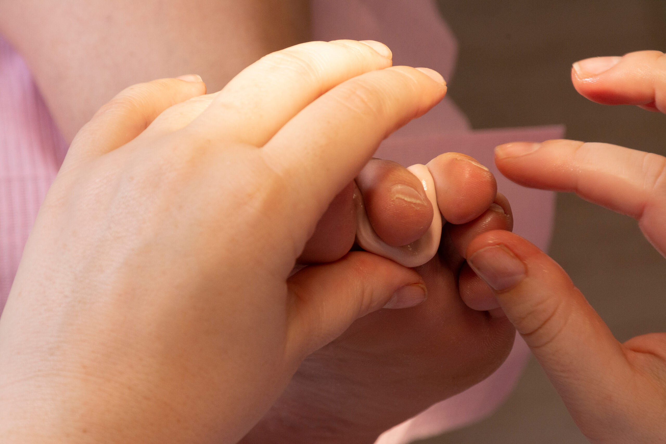 Penny Hunt Podiatrist treating a diabetic person's toes